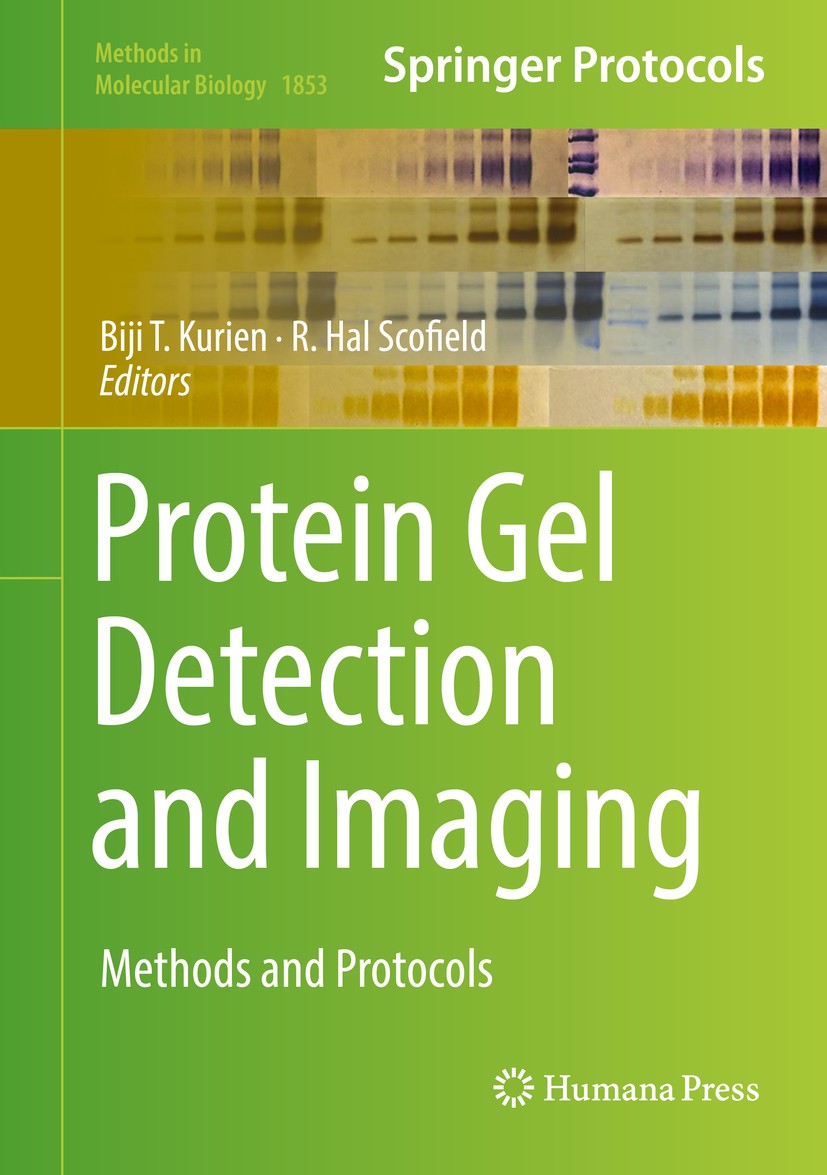 Titlebook: Protein Gel Detection and Imaging; Methods and Protocol Biji T. Kurien,R. Hal Scofield Book 2018 Springer Science+Business Media, LLC, part Titlebook: Protein Gel Detection and Imaging; Methods and Protocol Biji T. Kurien,R. Hal Scofield Book 2018 Springer Science+Business Media, LLC, part