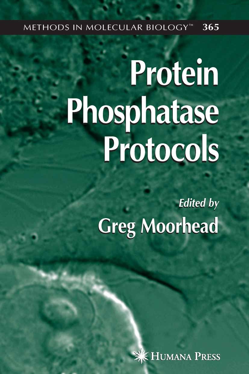 Titlebook: Protein Phosphatase Protocols; Greg Moorhead Book 2007 Humana Press 2007 Cell signaling networks.Drosophilia.Drug targets.Phosphatase fami Titlebook: Protein Phosphatase Protocols; Greg Moorhead Book 2007 Humana Press 2007 Cell signaling networks.Drosophilia.Drug targets.Phosphatase fami