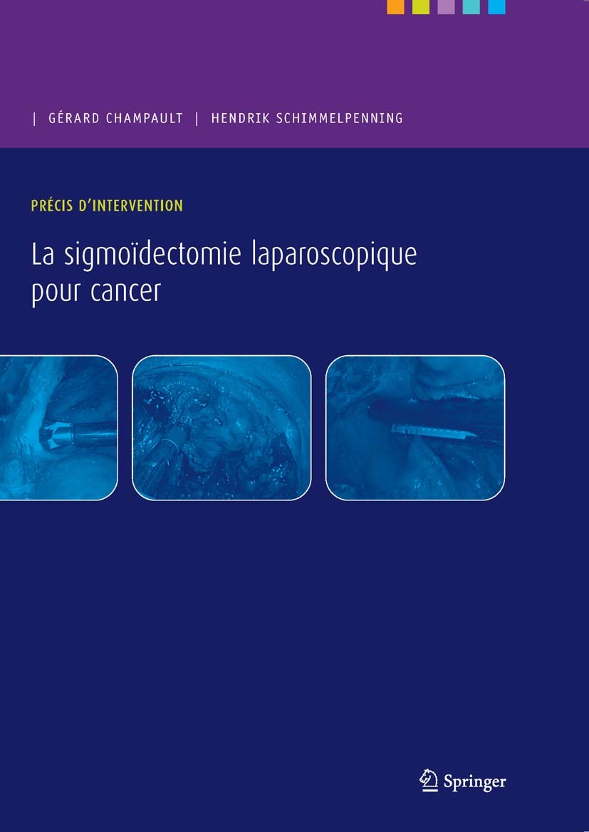 Titlebook: Précis d’intervention. La sigmoïdectomie laparoscopique pour cancer; Gérard Champault,Hendrik Schimmelpenning Book 2009Latest edition Spri Titlebook: Précis d’intervention. La sigmoïdectomie laparoscopique pour cancer; Gérard Champault,Hendrik Schimmelpenning Book 2009Latest edition Spri