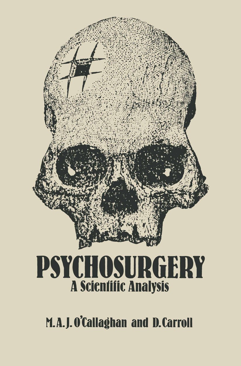 Titlebook: Psychosurgery; A Scientific Analysi Mark A. J. O’Callaghan,Douglas Carroll Book 1982 M. A. J. O’Callaghan and D. Carroll 1982 surgery Titlebook: Psychosurgery; A Scientific Analysi Mark A. J. O’Callaghan,Douglas Carroll Book 1982 M. A. J. O’Callaghan and D. Carroll 1982 surgery