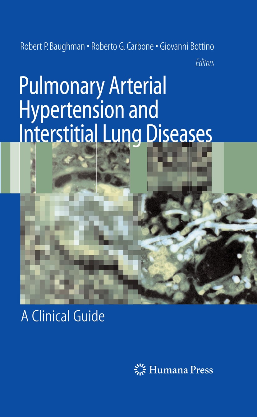Titlebook: Pulmonary Arterial Hypertension and Interstitial Lung Diseases; A Clinical Guide Robert P. Baughman,Roberto G. Carbone,Giovanni Bot Book 20 Titlebook: Pulmonary Arterial Hypertension and Interstitial Lung Diseases; A Clinical Guide Robert P. Baughman,Roberto G. Carbone,Giovanni Bot Book 20