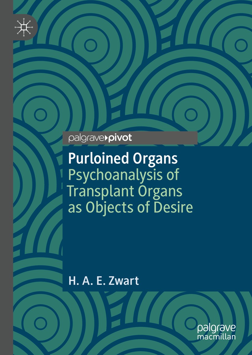 Titlebook: Purloined Organs; Psychoanalysis of Tr H.A.E. Zwart Book 2019 The Editor(s) (if applicable) and The Author(s), under exclusive license to S Titlebook: Purloined Organs; Psychoanalysis of Tr H.A.E. Zwart Book 2019 The Editor(s) (if applicable) and The Author(s), under exclusive license to S