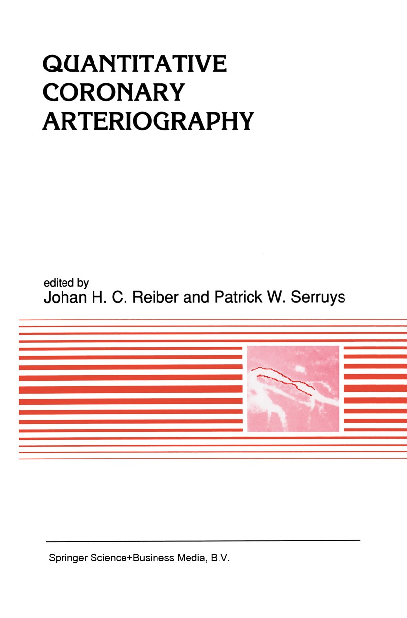 Titlebook: Quantitative Coronary Arteriography; Johan H. C. Reiber,Patrick W. Serruys Book 1991 Springer Science+Business Media Dordrecht 1991 Stent. Titlebook: Quantitative Coronary Arteriography; Johan H. C. Reiber,Patrick W. Serruys Book 1991 Springer Science+Business Media Dordrecht 1991 Stent.