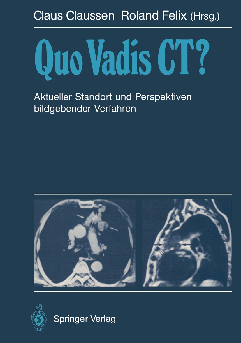 Titlebook: Quo Vadis CT?; Aktueller Standort u Claus Claussen,Roland Felix Conference proceedings 1988 Springer-Verlag Berlin Heidelberg 1988 Computer Titlebook: Quo Vadis CT?; Aktueller Standort u Claus Claussen,Roland Felix Conference proceedings 1988 Springer-Verlag Berlin Heidelberg 1988 Computer
