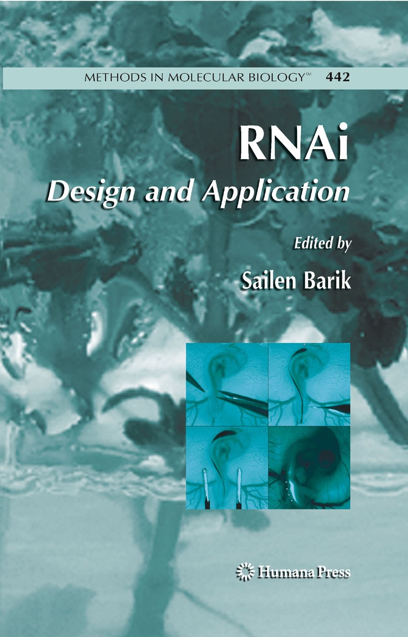 Titlebook: RNAi; Design and Applicati Sailen Barik Book 2008 Humana Press 2008 Evolution.Microarray.RNA interference.currentsara.genes.miRNA.siRNA Titlebook: RNAi; Design and Applicati Sailen Barik Book 2008 Humana Press 2008 Evolution.Microarray.RNA interference.currentsara.genes.miRNA.siRNA