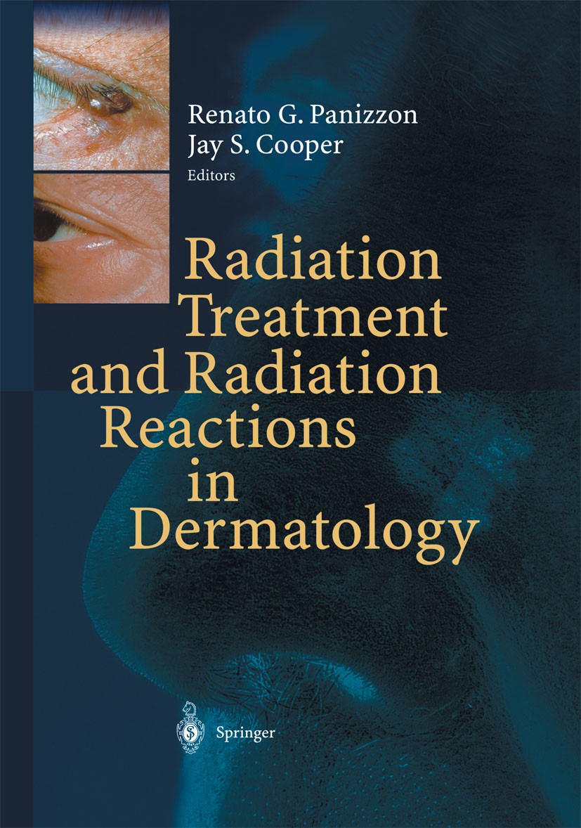 Titlebook: Radiation Treatment and Radiation Reactions in Dermatology; Renato G. Panizzon,Jay S. Cooper Book 20041st edition Springer-Verlag Berlin H Titlebook: Radiation Treatment and Radiation Reactions in Dermatology; Renato G. Panizzon,Jay S. Cooper Book 20041st edition Springer-Verlag Berlin H