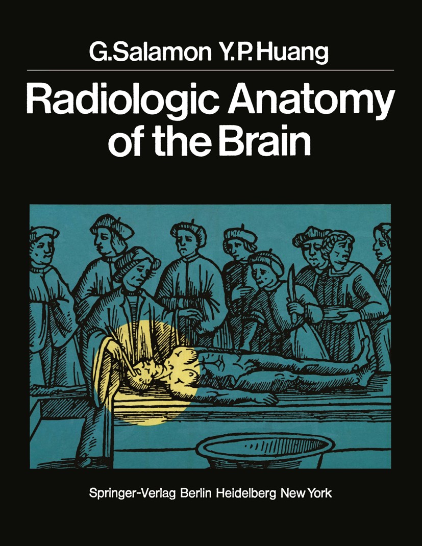 Titlebook: Radiologic Anatomy of the Brain; Georges Salamon,Yun Peng Huang,N. Christoff Book 1976 Springer-Verlag Berlin Heidelberg 1976 Anatomy.Gehi Titlebook: Radiologic Anatomy of the Brain; Georges Salamon,Yun Peng Huang,N. Christoff Book 1976 Springer-Verlag Berlin Heidelberg 1976 Anatomy.Gehi