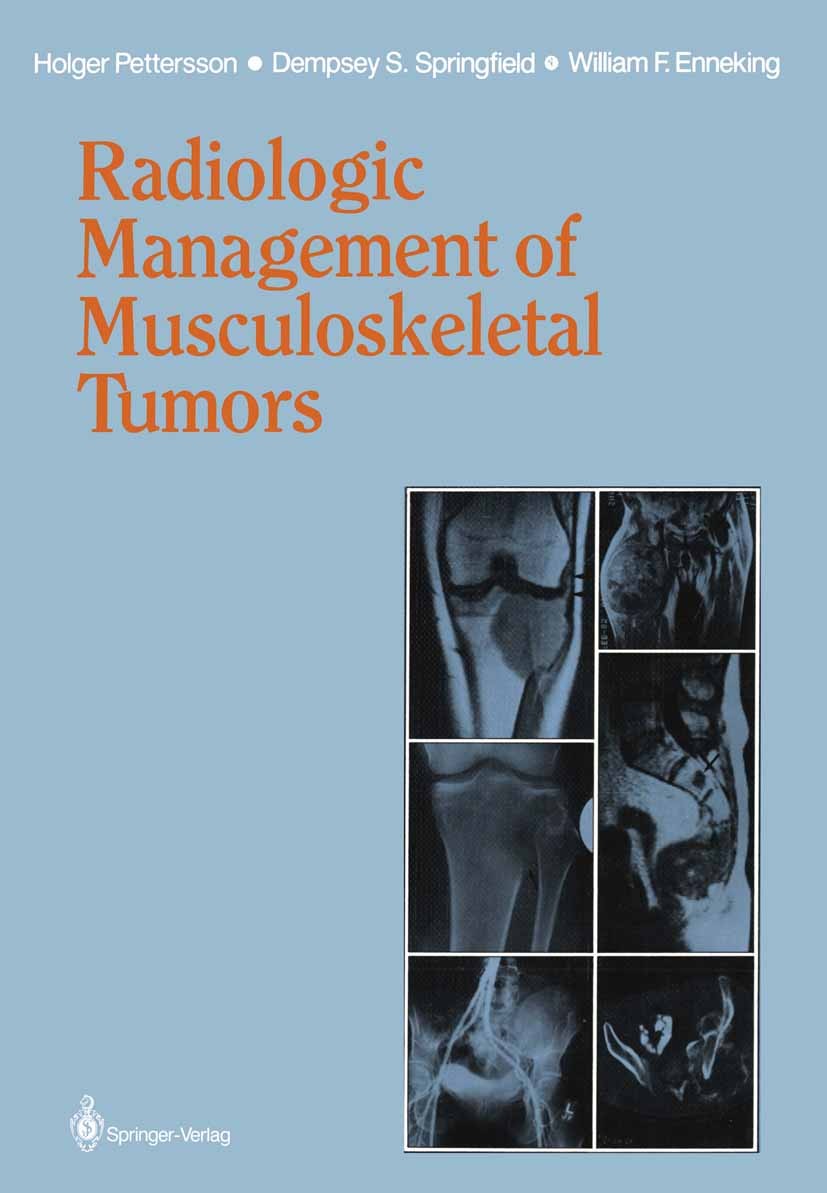 Titlebook: Radiologic Management of Musculoskeletal Tumors; Holger Pettersson,Dempsey S. Springfield,William F Book 1987 Springer-Verlag Berlin Heide Titlebook: Radiologic Management of Musculoskeletal Tumors; Holger Pettersson,Dempsey S. Springfield,William F Book 1987 Springer-Verlag Berlin Heide