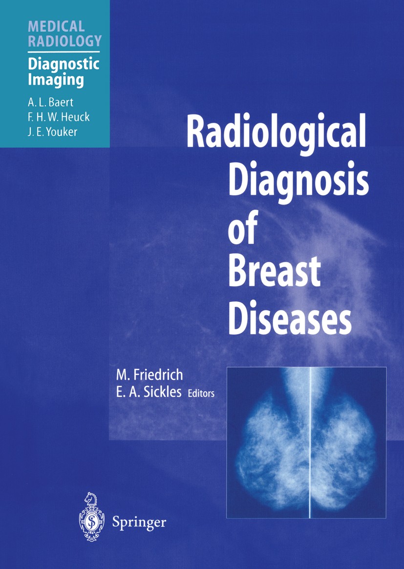 Titlebook: Radiological Diagnosis of Breast Diseases; Michael Friedrich (Professor),Edward A. Sickles (P Book 2000 Springer-Verlag Berlin · Heidelber Titlebook: Radiological Diagnosis of Breast Diseases; Michael Friedrich (Professor),Edward A. Sickles (P Book 2000 Springer-Verlag Berlin · Heidelber