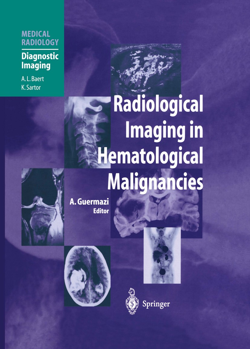 Titlebook: Radiological Imaging in Hematological Malignancies; Ali Guermazi (Visiting Associate Professor Departm Book 2004 Springer-Verlag Berlin He Titlebook: Radiological Imaging in Hematological Malignancies; Ali Guermazi (Visiting Associate Professor Departm Book 2004 Springer-Verlag Berlin He