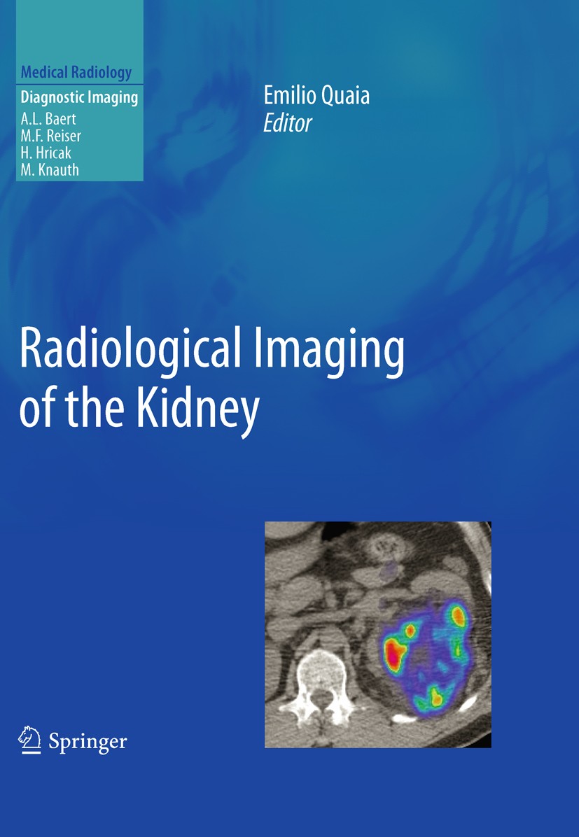 Titlebook: Radiological Imaging of the Kidney; Emilio Quaia Book 20111st edition Springer-Verlag Berlin Heidelberg 2011 Computed Tomography.Kidney.Ma Titlebook: Radiological Imaging of the Kidney; Emilio Quaia Book 20111st edition Springer-Verlag Berlin Heidelberg 2011 Computed Tomography.Kidney.Ma