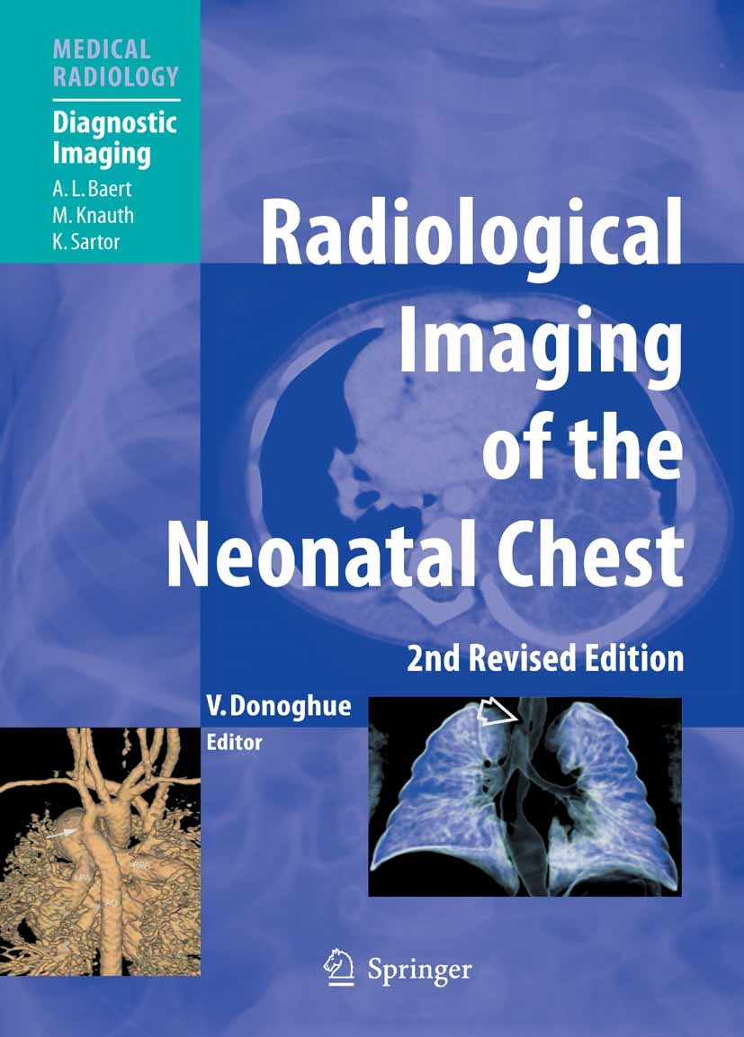 Titlebook: Radiological Imaging of the Neonatal Chest; Veronica Donoghue (Consultant Pediatric Radiologis Book 2008Latest edition Springer-Verlag Ber Titlebook: Radiological Imaging of the Neonatal Chest; Veronica Donoghue (Consultant Pediatric Radiologis Book 2008Latest edition Springer-Verlag Ber