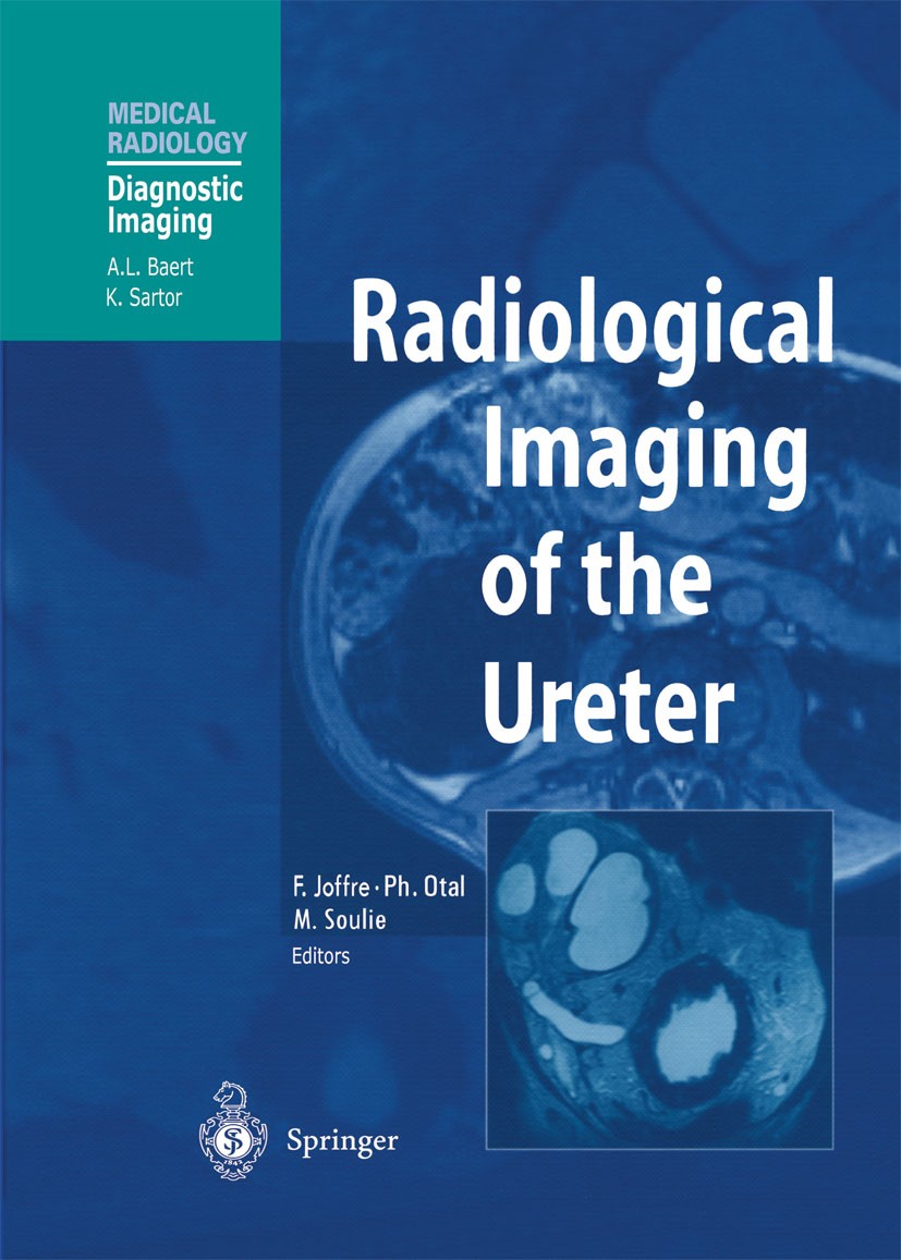 Titlebook: Radiological Imaging of the Ureter; Francis Joffre (Professor, Chef de Service),Philip Book 2003 Springer-Verlag Berlin Heidelberg 2003 Tu Titlebook: Radiological Imaging of the Ureter; Francis Joffre (Professor, Chef de Service),Philip Book 2003 Springer-Verlag Berlin Heidelberg 2003 Tu