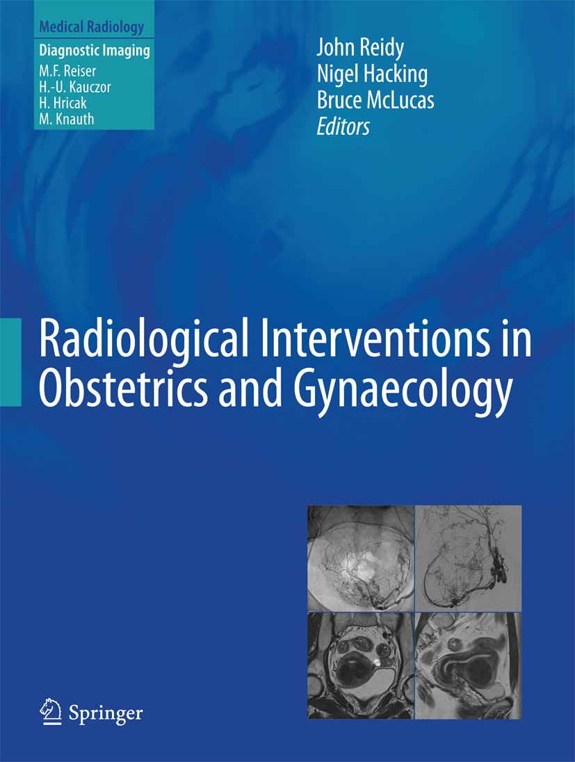 Titlebook: Radiological Interventions in Obstetrics and Gynaecology; John Reidy,Nigel Hacking,Bruce McLucas Book 2014 Springer Berlin Heidelberg 2014 Titlebook: Radiological Interventions in Obstetrics and Gynaecology; John Reidy,Nigel Hacking,Bruce McLucas Book 2014 Springer Berlin Heidelberg 2014
