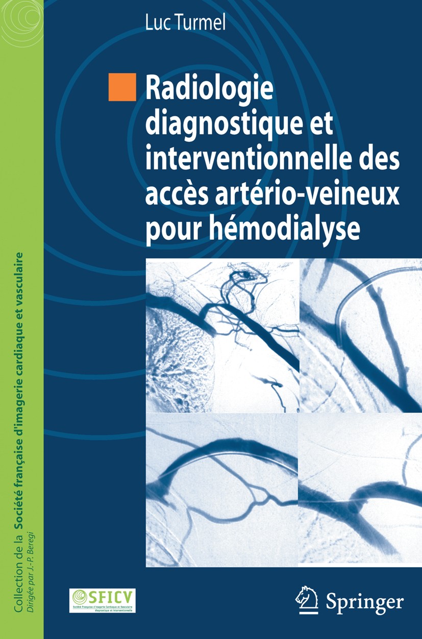 Titlebook: Radiologie diagnostique et interventionnelle des accès artério-veineux pour hémodialyse; Luc Turmel Book 2012Latest edition Springer-Verla Titlebook: Radiologie diagnostique et interventionnelle des accès artério-veineux pour hémodialyse; Luc Turmel Book 2012Latest edition Springer-Verla