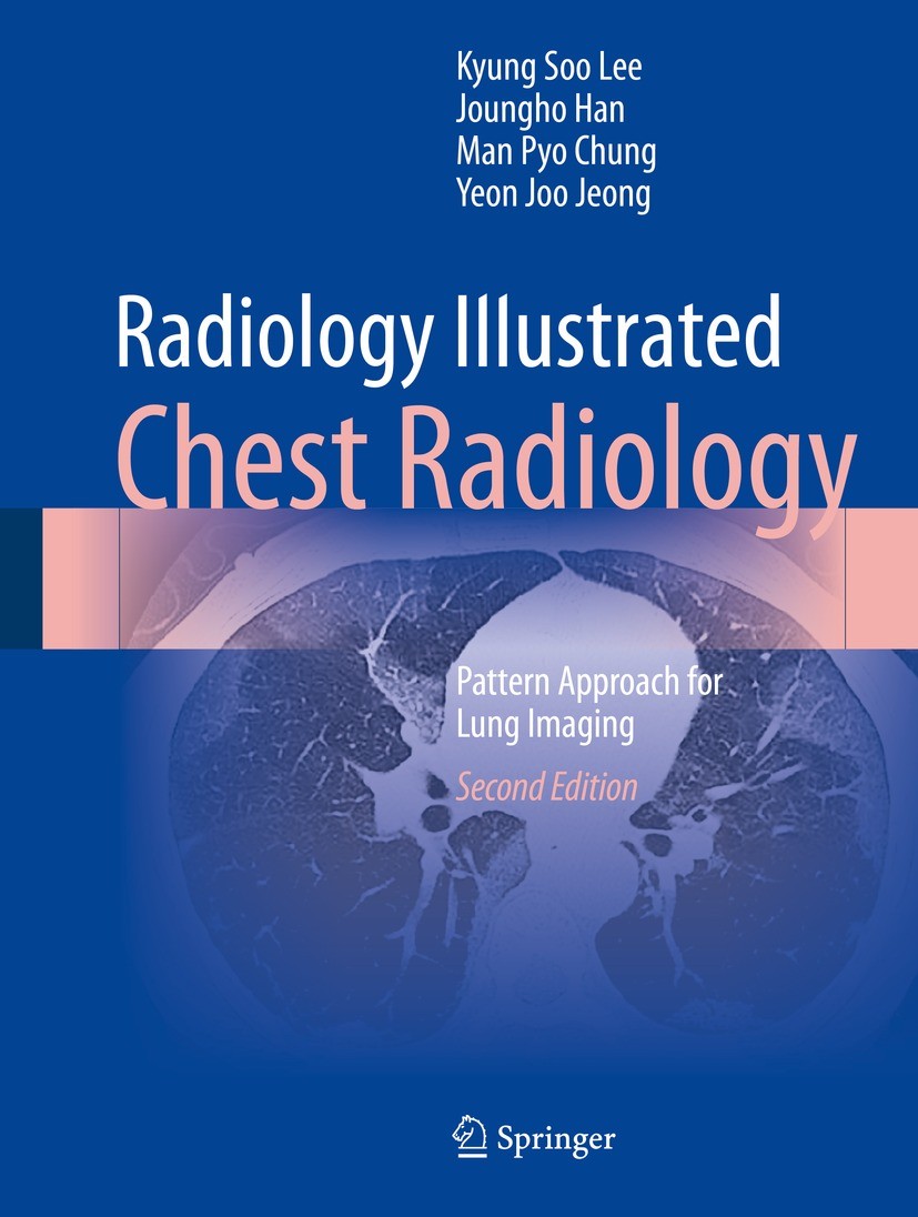 Titlebook: Radiology Illustrated: Chest Radiology; Pattern Approach for Kyung Soo Lee,Joungho Han,Yeon Joo Jeong Book 2023Latest edition The Editor(s) Titlebook: Radiology Illustrated: Chest Radiology; Pattern Approach for Kyung Soo Lee,Joungho Han,Yeon Joo Jeong Book 2023Latest edition The Editor(s)