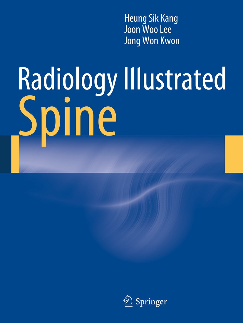 Titlebook: Radiology Illustrated: Spine; Heung Sik Kang,Joon Woo Lee,Jong Won Kwon Book 20141st edition Springer-Verlag Berlin Heidelberg 2014 neurol Titlebook: Radiology Illustrated: Spine; Heung Sik Kang,Joon Woo Lee,Jong Won Kwon Book 20141st edition Springer-Verlag Berlin Heidelberg 2014 neurol