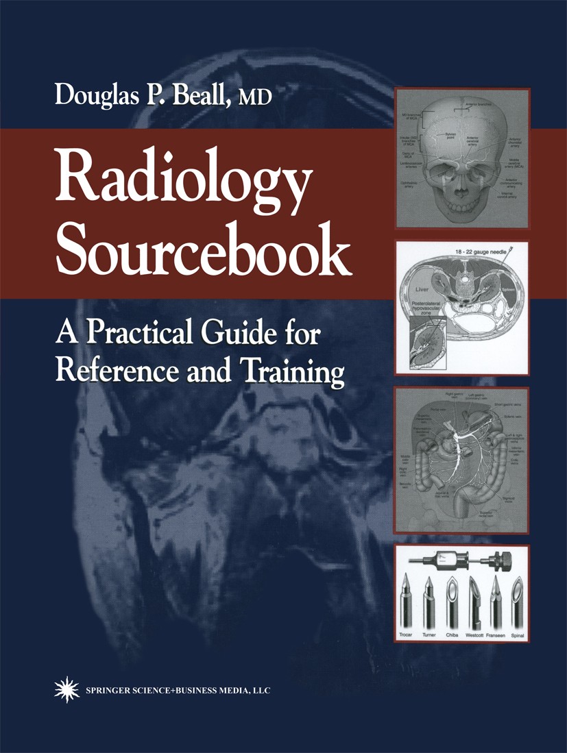 Titlebook: Radiology Sourcebook; A Practical Guide fo Douglas P. Beall Book 2002 Springer Science+Business Media New York 2002 angiography.diagnosis.i Titlebook: Radiology Sourcebook; A Practical Guide fo Douglas P. Beall Book 2002 Springer Science+Business Media New York 2002 angiography.diagnosis.i
