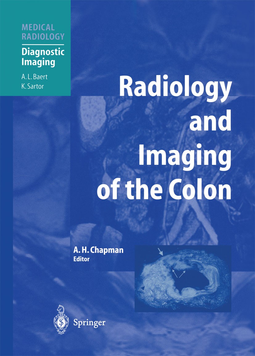 Titlebook: Radiology and Imaging of the Colon; Anthony H. Chapman Book 2004 Springer-Verlag Berlin Heidelberg 2004 CT.Staging.cancer.carcinoma.colon. Titlebook: Radiology and Imaging of the Colon; Anthony H. Chapman Book 2004 Springer-Verlag Berlin Heidelberg 2004 CT.Staging.cancer.carcinoma.colon.