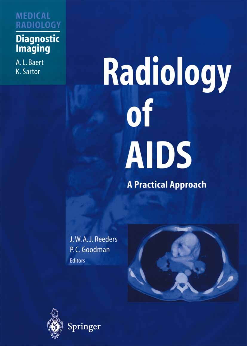 Titlebook: Radiology of AIDS; Jacques W. A. J. Reeders (Consultant (Intervention Book 2001 Springer-Verlag Berlin Heidelberg 2001 AIDS.HIV.HIV infect Titlebook: Radiology of AIDS; Jacques W. A. J. Reeders (Consultant (Intervention Book 2001 Springer-Verlag Berlin Heidelberg 2001 AIDS.HIV.HIV infect
