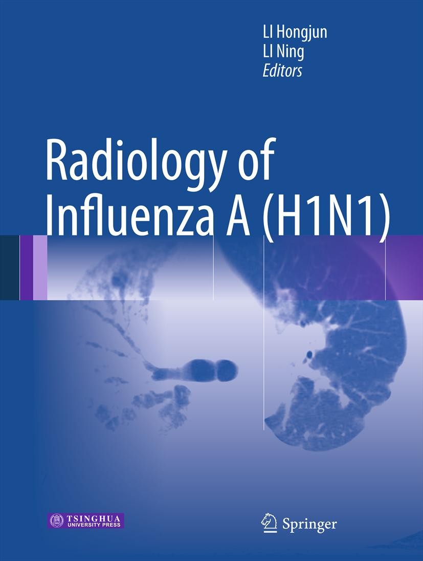 Titlebook: Radiology of Influenza A (H1N1); Hongjun Li,Ning Li Book 2013 Springer Science+Business Media B.V., Dordrecht and Tsinghua University Pres Titlebook: Radiology of Influenza A (H1N1); Hongjun Li,Ning Li Book 2013 Springer Science+Business Media B.V., Dordrecht and Tsinghua University Pres