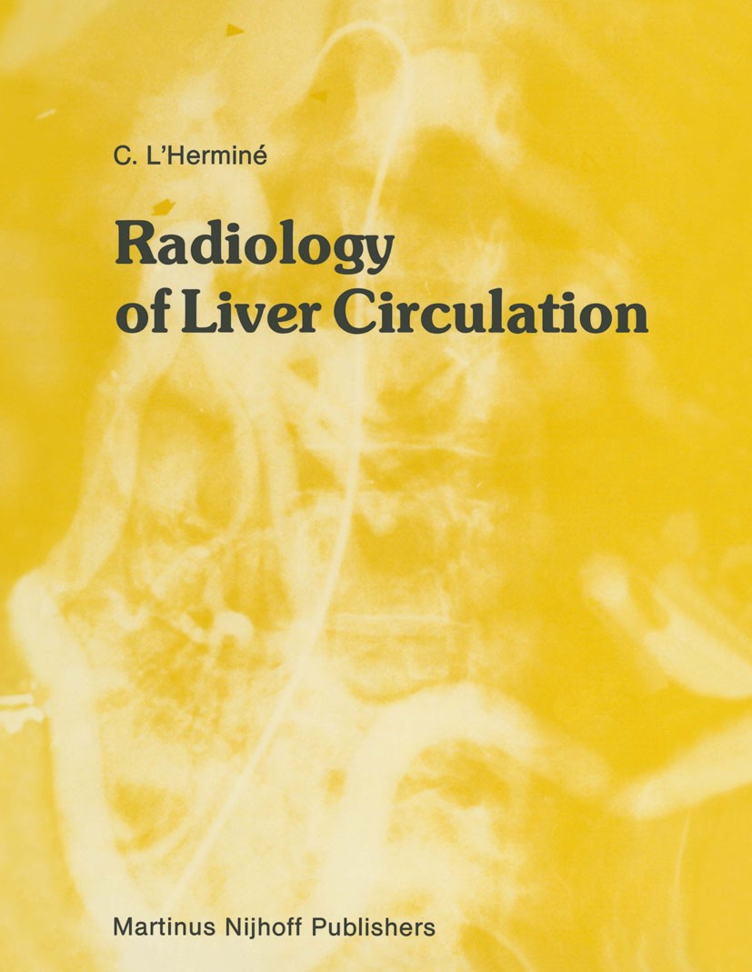 Titlebook: Radiology of Liver Circulation; Claude L’Herminé Book 1985 Martinus Nijhoff Publishers, Dordrecht 1985 Tumor.computed tomography (CT).diag Titlebook: Radiology of Liver Circulation; Claude L’Herminé Book 1985 Martinus Nijhoff Publishers, Dordrecht 1985 Tumor.computed tomography (CT).diag