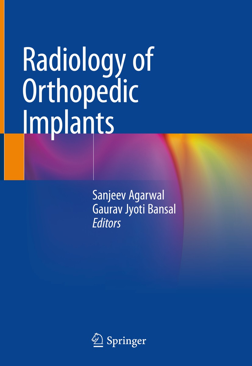 Titlebook: Radiology of Orthopedic Implants; Sanjeev Agarwal,Gaurav Jyoti Bansal Book 2018 Springer International Publishing AG, part of Springer Nat Titlebook: Radiology of Orthopedic Implants; Sanjeev Agarwal,Gaurav Jyoti Bansal Book 2018 Springer International Publishing AG, part of Springer Nat