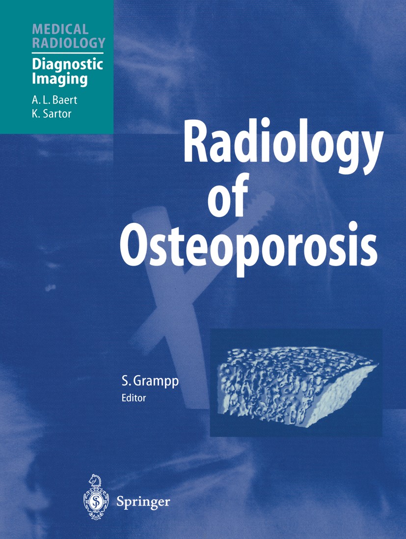 Titlebook: Radiology of Osteoporosis; Stephan Grampp (Professor) Book 20031st edition Springer-Verlag Berlin Heidelberg 2003 X-ray.computed tomograph Titlebook: Radiology of Osteoporosis; Stephan Grampp (Professor) Book 20031st edition Springer-Verlag Berlin Heidelberg 2003 X-ray.computed tomograph