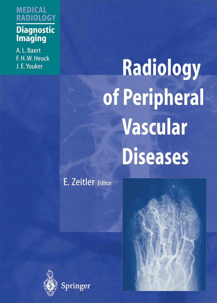 Titlebook: Radiology of Peripheral Vascular Diseases; Eberhard Zeitler (Professor) Book 2000 Springer-Verlag Berlin Heidelberg 2000 Angiologie.Gefäßc Titlebook: Radiology of Peripheral Vascular Diseases; Eberhard Zeitler (Professor) Book 2000 Springer-Verlag Berlin Heidelberg 2000 Angiologie.Gefäßc