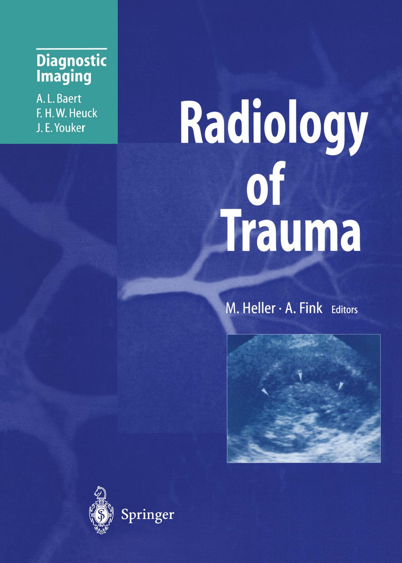 Titlebook: Radiology of Trauma; Martin Heller,Andreas Fink Book 2000 Springer-Verlag Berlin · Heidelberg 2000 Radiologische Diagnostik.Surgery.Unfall Titlebook: Radiology of Trauma; Martin Heller,Andreas Fink Book 2000 Springer-Verlag Berlin · Heidelberg 2000 Radiologische Diagnostik.Surgery.Unfall