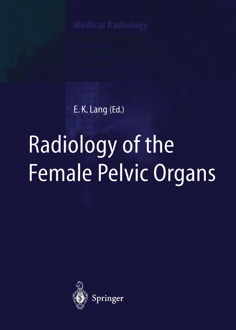 Titlebook: Radiology of the Female Pelvic Organs; Erich K. Lang (Professor of Radiology and Urology) Book 1998 Springer-Verlag Berlin Heidelberg 1998 Titlebook: Radiology of the Female Pelvic Organs; Erich K. Lang (Professor of Radiology and Urology) Book 1998 Springer-Verlag Berlin Heidelberg 1998