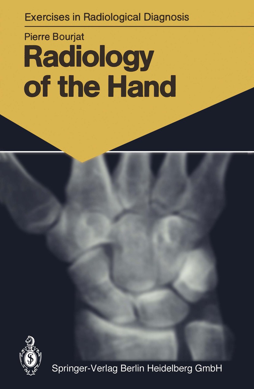 Titlebook: Radiology of the Hand; 147 Radiological Exe Pierre Bourjat Book 1987 Springer-Verlag Berlin Heidelberg 1987 Röntgen.diagnosis.hand.patholog Titlebook: Radiology of the Hand; 147 Radiological Exe Pierre Bourjat Book 1987 Springer-Verlag Berlin Heidelberg 1987 Röntgen.diagnosis.hand.patholog