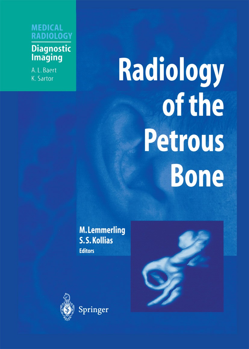 Titlebook: Radiology of the Petrous Bone; Marc Lemmerling,Spyros S. Kollias Book 2004 Springer-Verlag Berlin Heidelberg 2004 Tumor.anatomy.bone.ear.h Titlebook: Radiology of the Petrous Bone; Marc Lemmerling,Spyros S. Kollias Book 2004 Springer-Verlag Berlin Heidelberg 2004 Tumor.anatomy.bone.ear.h