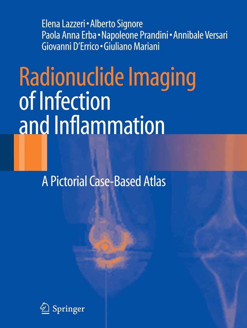 Titlebook: Radionuclide Imaging of Infection and Inflammation; A Pictorial Case-Bas Elena Lazzeri,Alberto Signore,Giuliano Mariani Book 20131st editio Titlebook: Radionuclide Imaging of Infection and Inflammation; A Pictorial Case-Bas Elena Lazzeri,Alberto Signore,Giuliano Mariani Book 20131st editio