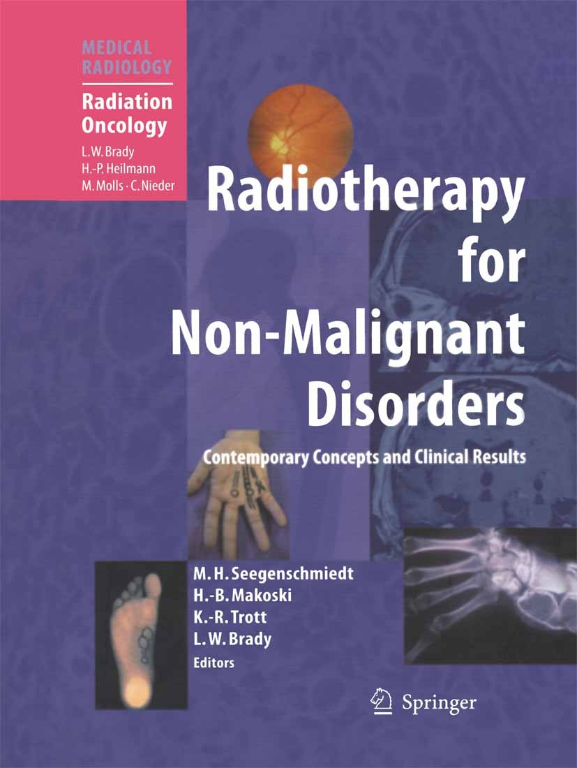 Titlebook: Radiotherapy for Non-Malignant Disorders; Michael Heinrich Seegenschmiedt (Professor),Hans-B Book 2008 Springer-Verlag Berlin Heidelberg 2 Titlebook: Radiotherapy for Non-Malignant Disorders; Michael Heinrich Seegenschmiedt (Professor),Hans-B Book 2008 Springer-Verlag Berlin Heidelberg 2