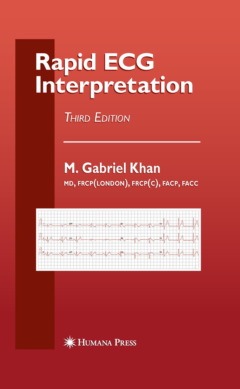 Titlebook: Rapid ECG Interpretation; M. Gabriel Khan (Associate Professor of Medicine) Book 2008Latest edition Humana Press 2008 Stent.cardiology.car Titlebook: Rapid ECG Interpretation; M. Gabriel Khan (Associate Professor of Medicine) Book 2008Latest edition Humana Press 2008 Stent.cardiology.car