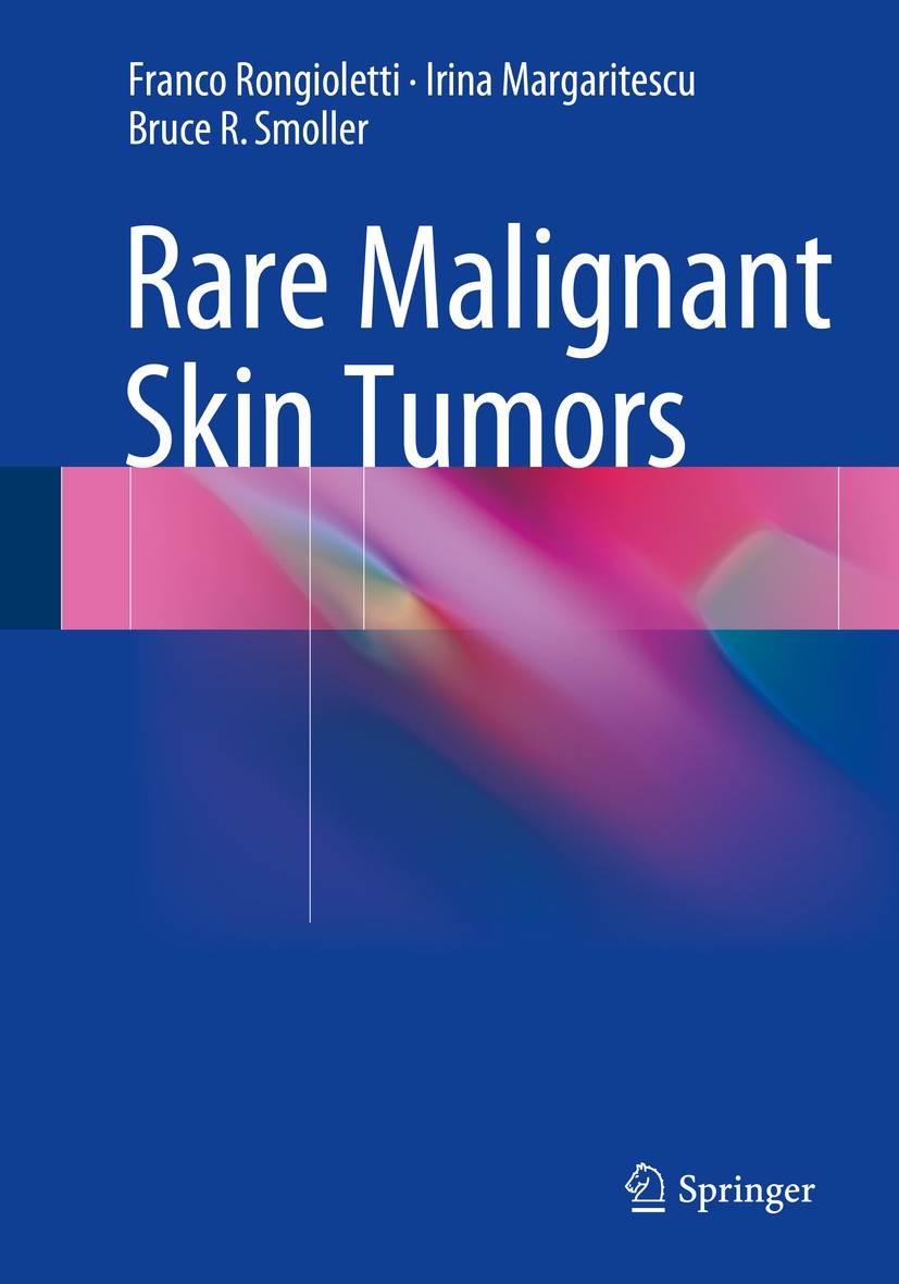Titlebook: Rare Malignant Skin Tumors; Franco Rongioletti,Irina Margaritescu,Bruce R Smol Book 2015 Springer Science+Business Media New York 2015 cut Titlebook: Rare Malignant Skin Tumors; Franco Rongioletti,Irina Margaritescu,Bruce R Smol Book 2015 Springer Science+Business Media New York 2015 cut