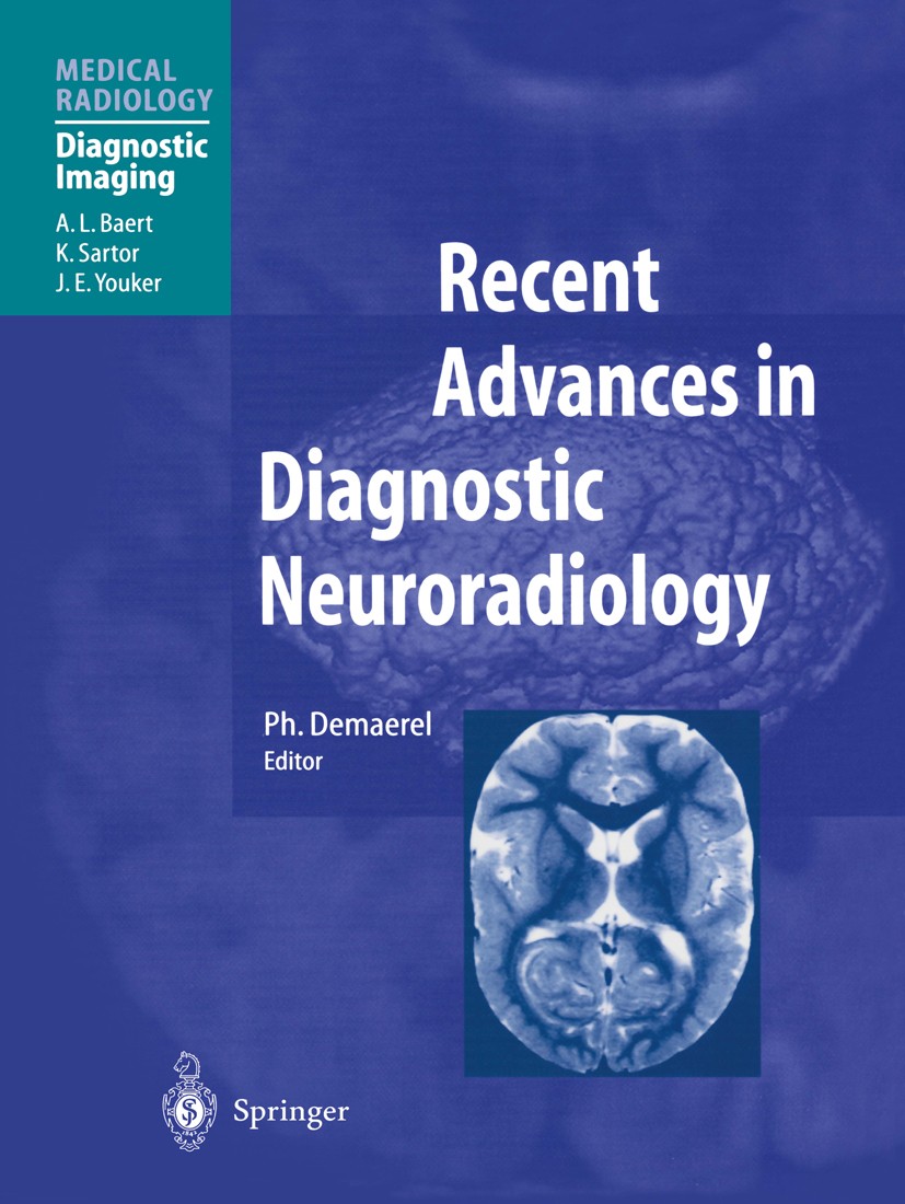 Titlebook: Recent Advances in Diagnostic Neuroradiology; Philippe Demaerel (Professor) Book 2001 Springer-Verlag Berlin Heidelberg 2001 Hirn.MR imagi Titlebook: Recent Advances in Diagnostic Neuroradiology; Philippe Demaerel (Professor) Book 2001 Springer-Verlag Berlin Heidelberg 2001 Hirn.MR imagi
