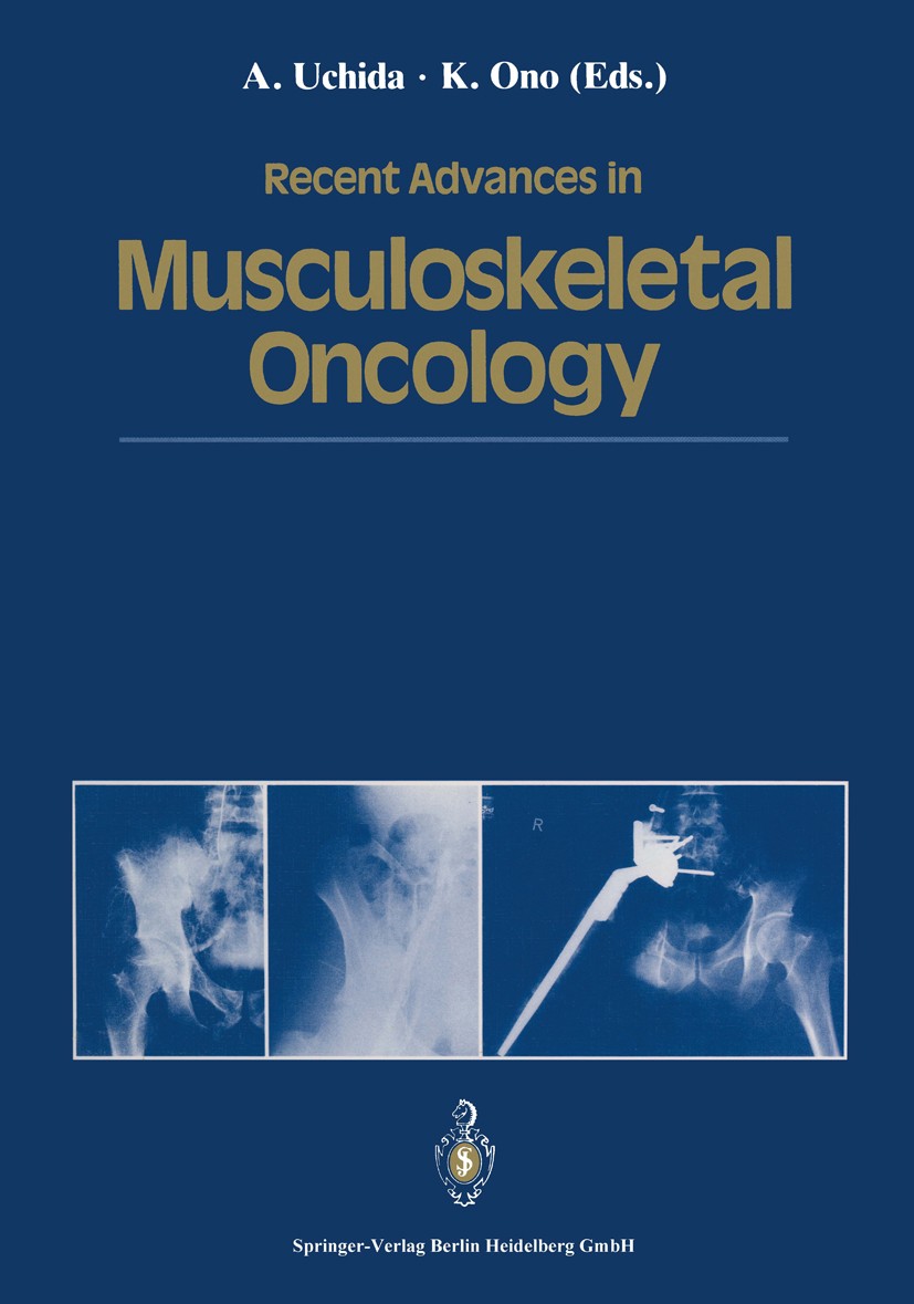 Titlebook: Recent Advances in Musculoskeletal Oncology; Atsumasa Uchida,Keiro Ono Conference proceedings 1992 Springer Japan 1992 bone.cancer.chemoth Titlebook: Recent Advances in Musculoskeletal Oncology; Atsumasa Uchida,Keiro Ono Conference proceedings 1992 Springer Japan 1992 bone.cancer.chemoth