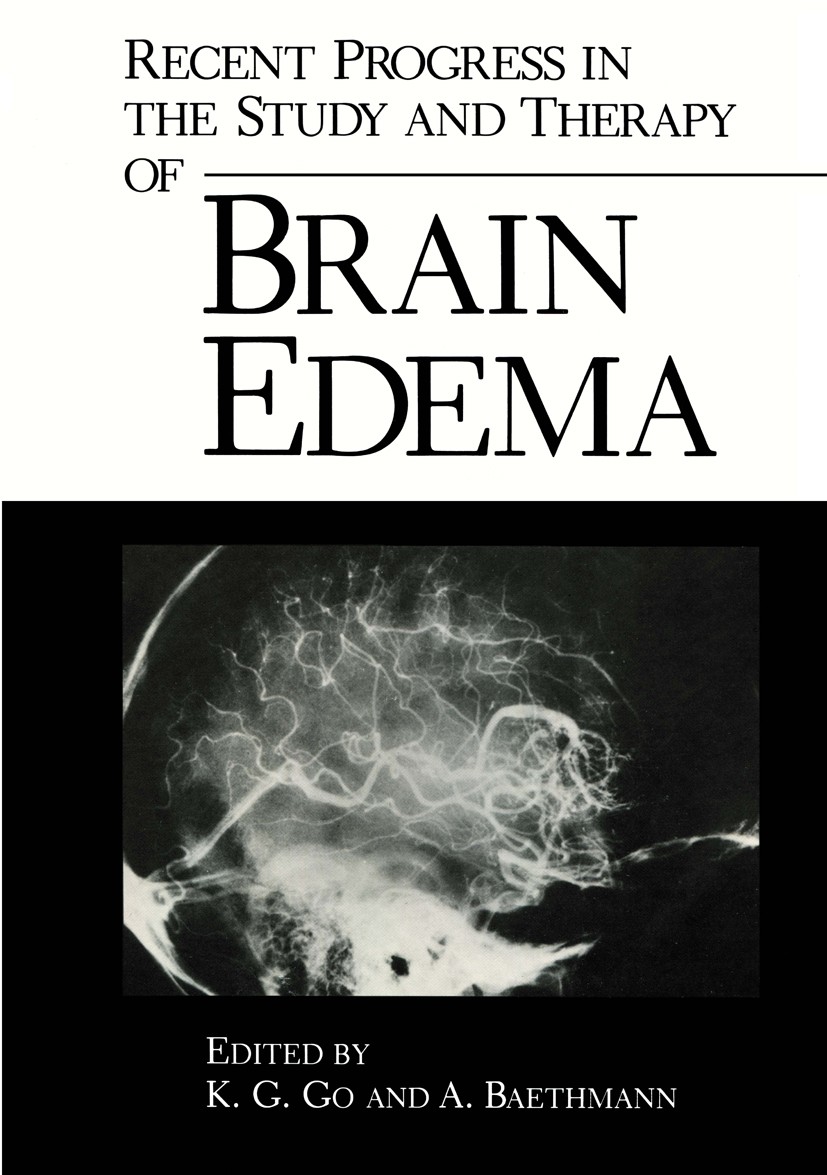 Titlebook: Recent Progress in the Study and Therapy of Brain Edema; K. G. Go,A. Baethmann Book 1984 Plenum Press, New York 1984 Hydrocephalus.biochem Titlebook: Recent Progress in the Study and Therapy of Brain Edema; K. G. Go,A. Baethmann Book 1984 Plenum Press, New York 1984 Hydrocephalus.biochem