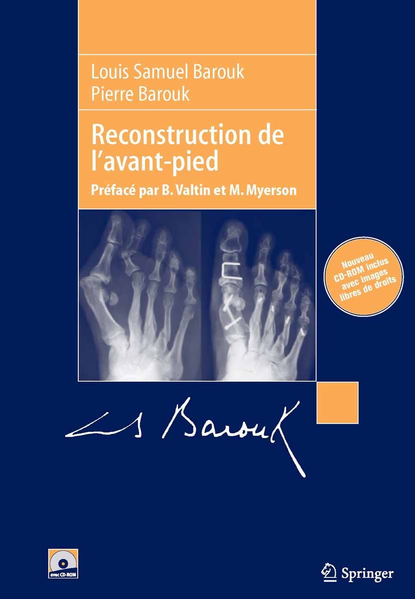 Titlebook: Reconstruction de l‘avant-pied; Louis Samuel Barouk,Pierre Barouk Book 2006Latest edition Springer-Verlag Paris 2006 Avant-pied.Hallux val Titlebook: Reconstruction de l‘avant-pied; Louis Samuel Barouk,Pierre Barouk Book 2006Latest edition Springer-Verlag Paris 2006 Avant-pied.Hallux val