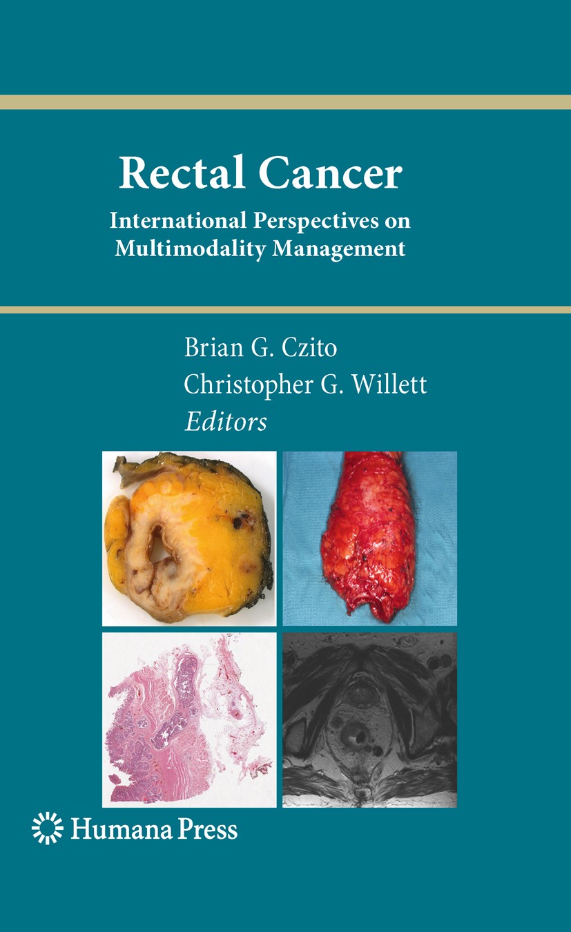 Titlebook: Rectal Cancer; International Perspe Brian G. Czito,Christopher G. Willett Book 2010 Springer Science + Business Media, LLC 2010 Cancer.Carc Titlebook: Rectal Cancer; International Perspe Brian G. Czito,Christopher G. Willett Book 2010 Springer Science + Business Media, LLC 2010 Cancer.Carc