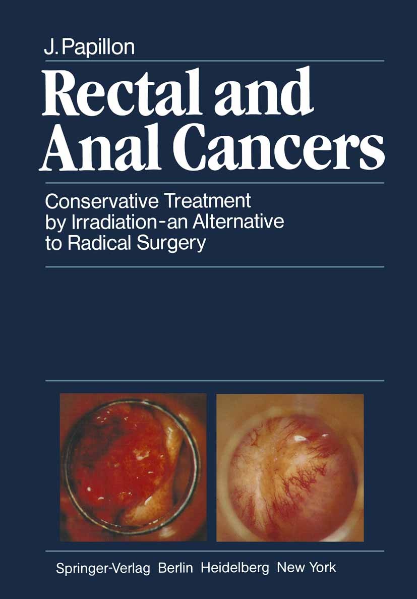 Titlebook: Rectal and Anal Cancers; Conservative Treatme Jean Papillon Book 1982 Springer-Verlag Berlin Heidelberg 1982 Analkrebs.Mastdarmkrebs.behavi Titlebook: Rectal and Anal Cancers; Conservative Treatme Jean Papillon Book 1982 Springer-Verlag Berlin Heidelberg 1982 Analkrebs.Mastdarmkrebs.behavi