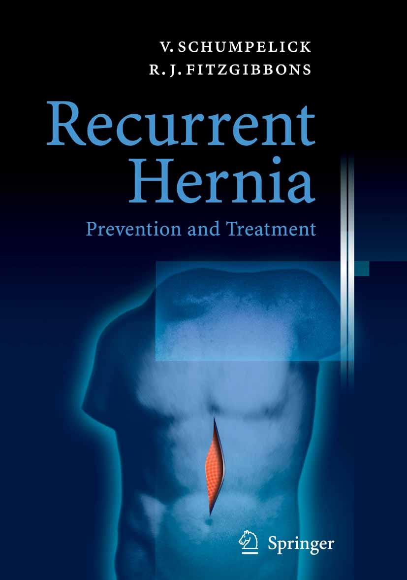 Titlebook: Recurrent Hernia; Prevention and Treat Volker Schumpelick,Robert J. Fitzgibbons Textbook 2007 Springer-Verlag Berlin Heidelberg 2007 abdomi Titlebook: Recurrent Hernia; Prevention and Treat Volker Schumpelick,Robert J. Fitzgibbons Textbook 2007 Springer-Verlag Berlin Heidelberg 2007 abdomi