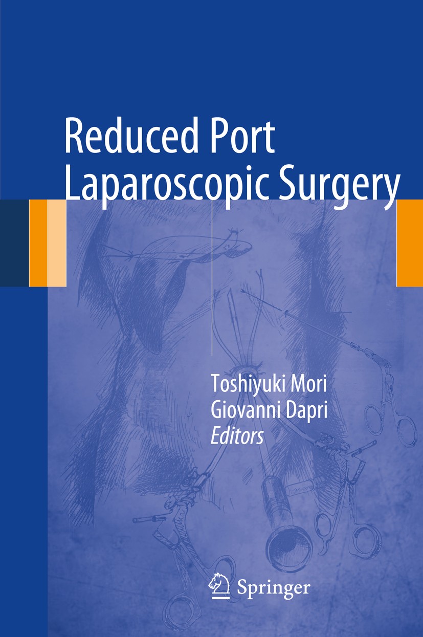Titlebook: Reduced Port Laparoscopic Surgery; Toshiyuki Mori,Giovanni Dapri Book 2014 Springer Japan 2014 abdominal surgery.cholecystectomy.laparosco Titlebook: Reduced Port Laparoscopic Surgery; Toshiyuki Mori,Giovanni Dapri Book 2014 Springer Japan 2014 abdominal surgery.cholecystectomy.laparosco