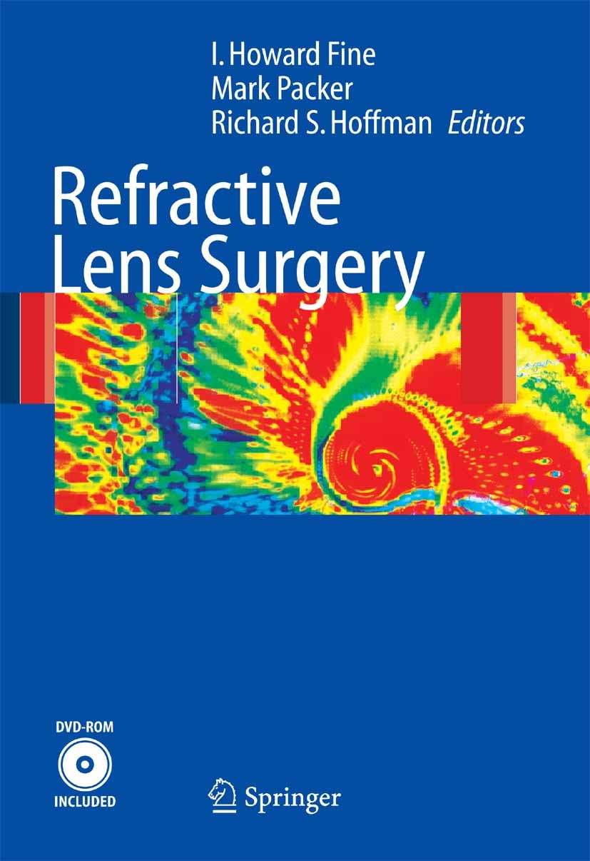 Titlebook: Refractive Lens Surgery; I. Howard Fine,Mark Packer,Richard. S. Hoffman Book 2005 Springer-Verlag Berlin Heidelberg 2005 Accomodative IOLS Titlebook: Refractive Lens Surgery; I. Howard Fine,Mark Packer,Richard. S. Hoffman Book 2005 Springer-Verlag Berlin Heidelberg 2005 Accomodative IOLS