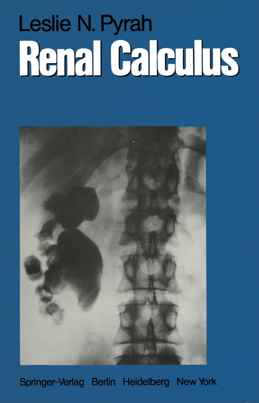 Titlebook: Renal Calculus; Leslie N. Pyrah Book 1979 Springer-Verlag Berlin Heidelberg 1979 Harnleiterstein.Nierenstein.calculus.kidney.surgery Titlebook: Renal Calculus; Leslie N. Pyrah Book 1979 Springer-Verlag Berlin Heidelberg 1979 Harnleiterstein.Nierenstein.calculus.kidney.surgery