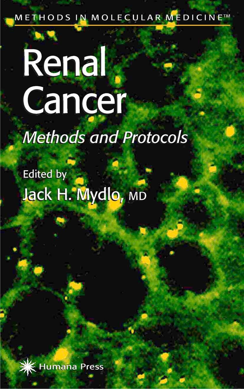 Titlebook: Renal Cancer; Methods and Protocol Jack H. Mydlo Book 2001 Humana Press 2001 Titlebook: Renal Cancer; Methods and Protocol Jack H. Mydlo Book 2001 Humana Press 2001