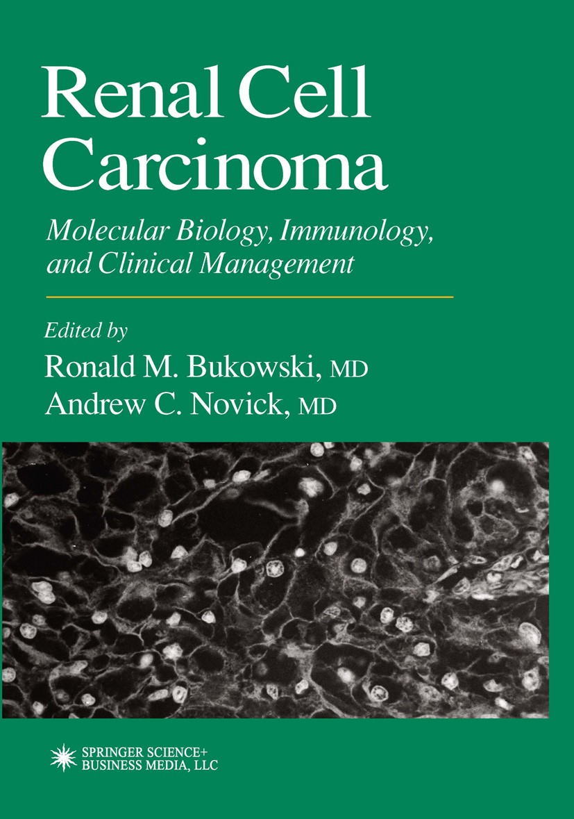 Titlebook: Renal Cell Carcinoma; Molecular Biology, I Ronald M. Bukowski (Director),Andrew C. Novick (Ch Book 20001st edition Springer Science+Busines Titlebook: Renal Cell Carcinoma; Molecular Biology, I Ronald M. Bukowski (Director),Andrew C. Novick (Ch Book 20001st edition Springer Science+Busines