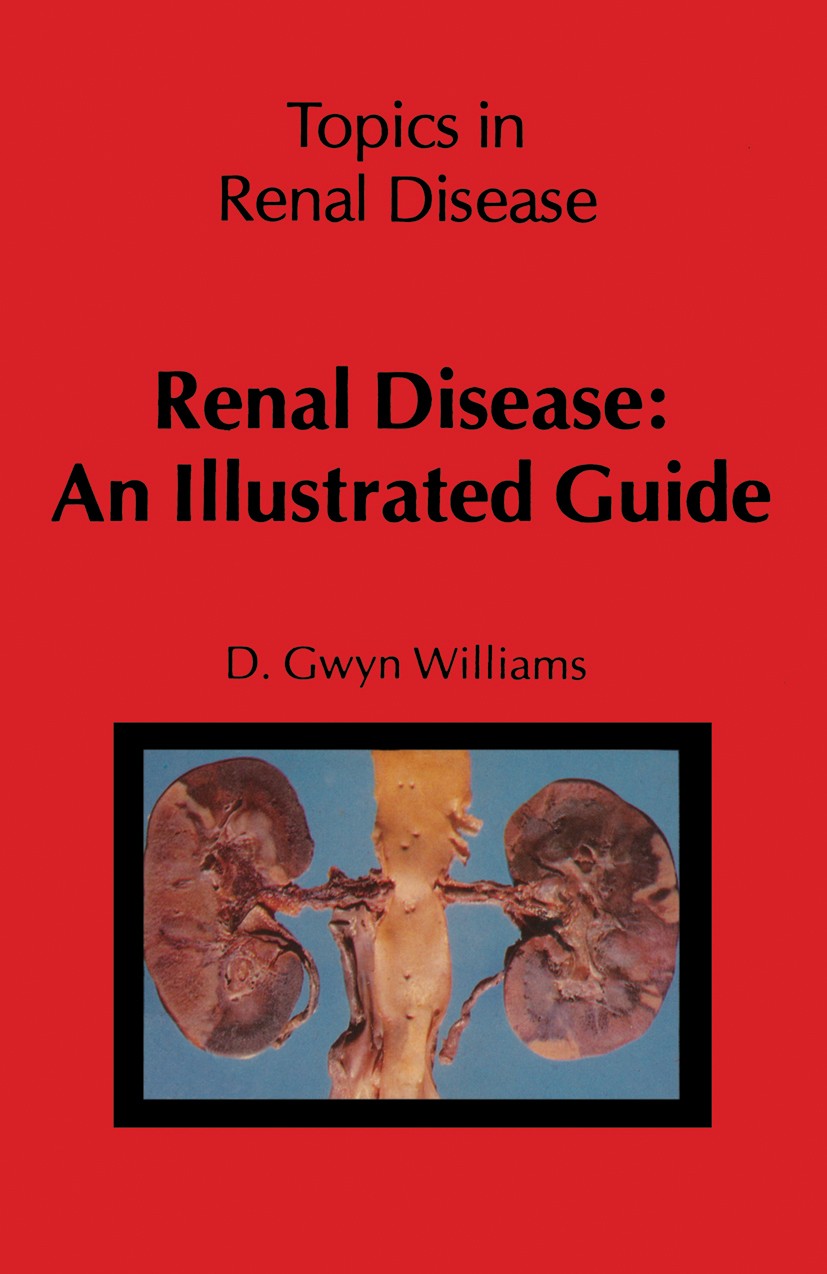 Titlebook: Renal Disease: An Illustrated Guide; D. Gwyn Williams Book 1981 MTP Press Limited 1981 arteries.artery.biopsy.drugs.histology.immunology.k Titlebook: Renal Disease: An Illustrated Guide; D. Gwyn Williams Book 1981 MTP Press Limited 1981 arteries.artery.biopsy.drugs.histology.immunology.k